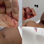 NORBERTO GARCIA ESFAQUEADO DURANTE ASSALTO NO COMPLEXO BOAVIDA