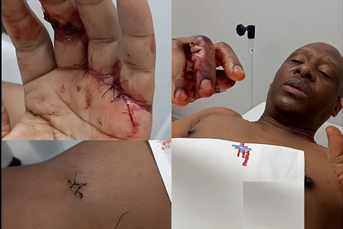 NORBERTO GARCIA ESFAQUEADO DURANTE ASSALTO NO COMPLEXO BOAVIDA